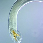Don’t ignore drug-resistant parasites