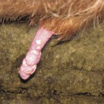 Severe penile warts.