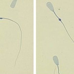 Proximal droplets (l) and distal droplets (r)