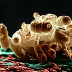 E. coli.