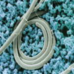 A scanning electron micrograph of Salmonella enteritidis cells. (P.J. Guard-Petter photo, digitally colourized by Stephen Ausmus, courtesy ARS/USDA)