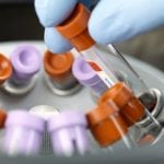 Serums produced from fetal bovine blood used in the pharmaceutical industry are vital to the production of vaccines.