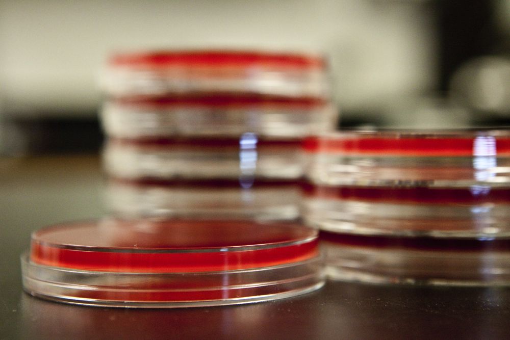 Recent bovine TB strain new to Canada