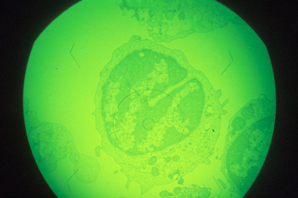 A macrophage (immune response) cell in early stages of infection with African swine fever virus, magnified about 1,000x. (Keith Weller photo courtesy ARS/USDA)
