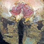 Digital dermatitis.