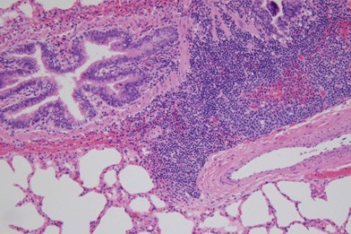 Lung pathology in Mycoplasma bovis-infected cattle at 10x magnification. (VIDO.org)