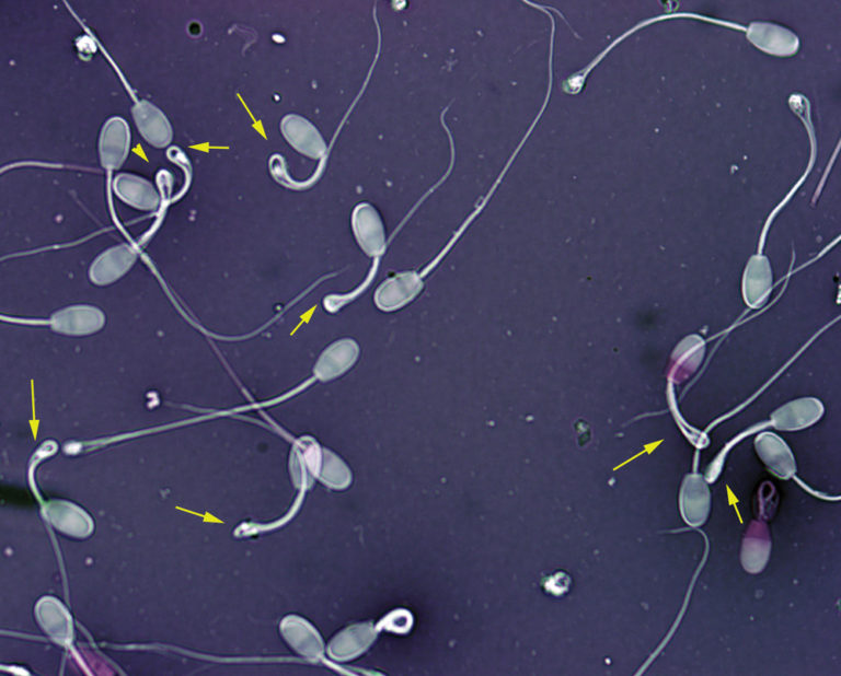 Factors that affect bull fertility Canadian Cattlemen