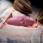 A genetically engineered pig kidney appears healthy during a transplant operation at NYU Langone in New York. (Photo: Joe Carrotta/NYU Langone Health/Handout via Reuters)