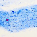 cryptosporidium parvum