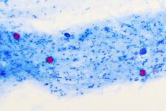 cryptosporidium parvum