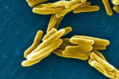 Tuberculosis bacteria under an electron microscope. (Janice Haney Carr photo courtesy Centers for Disease Control and Prevention (U.S.))