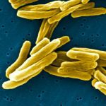 Tuberculosis bacteria under an electron microscope.